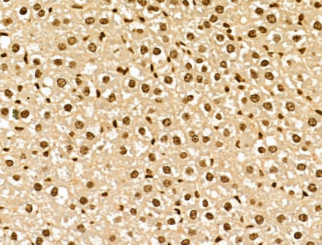 NCOA6 Antibody in Immunohistochemistry (Paraffin) (IHC (P))