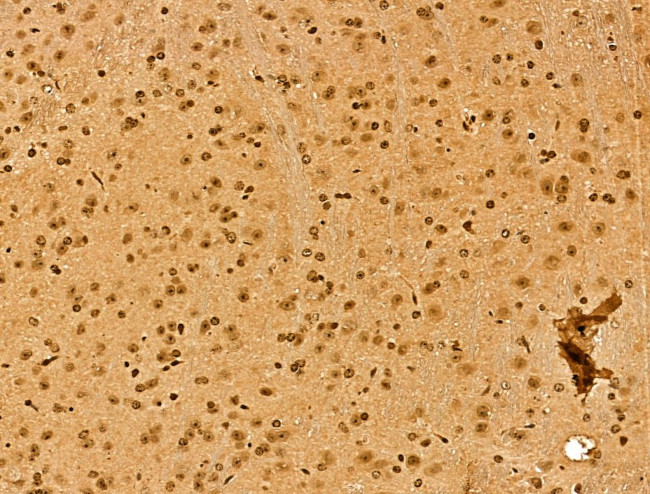 NCOA6 Antibody in Immunohistochemistry (Paraffin) (IHC (P))