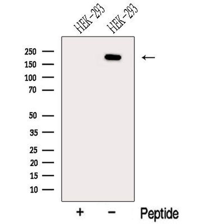 NCOA6 Antibody in Western Blot (WB)