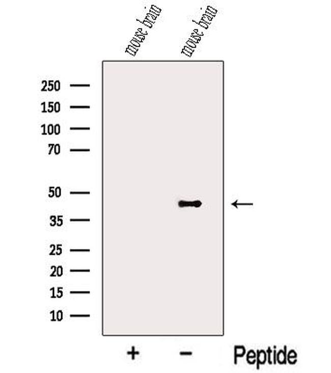 NECAB2 Antibody in Western Blot (WB)