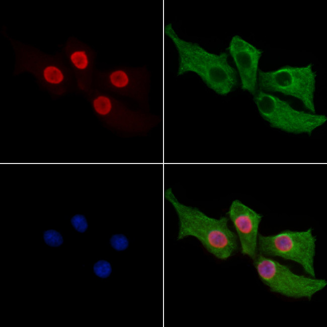 NALP1 Antibody in Immunocytochemistry (ICC/IF)