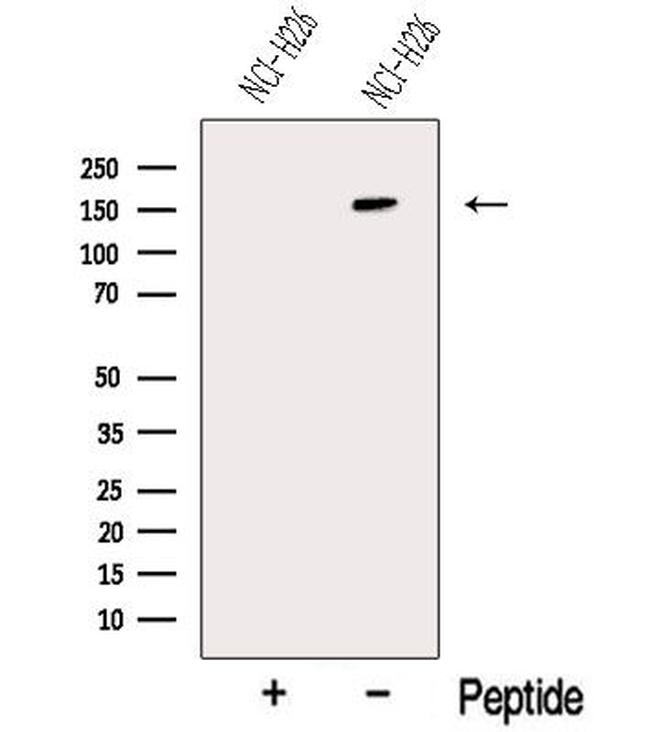 NALP1 Antibody in Western Blot (WB)