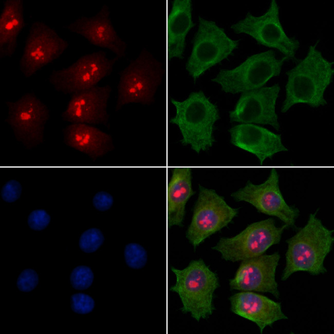 NOP58 Antibody in Immunocytochemistry (ICC/IF)