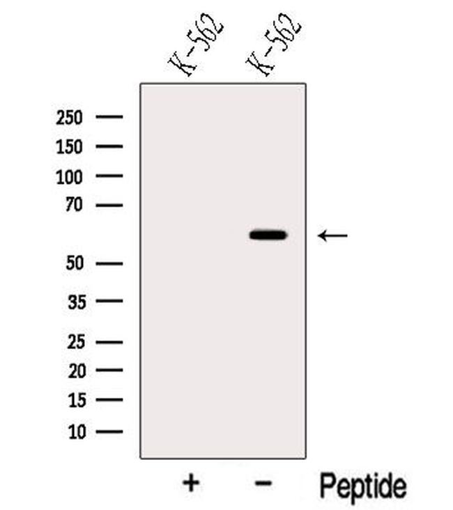 NOP58 Antibody in Western Blot (WB)