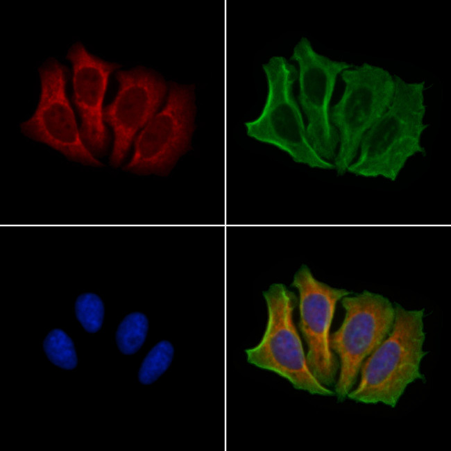 NOXA Antibody in Immunocytochemistry (ICC/IF)