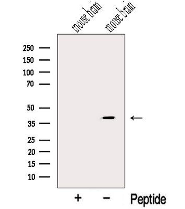 NUDT9 Antibody in Western Blot (WB)