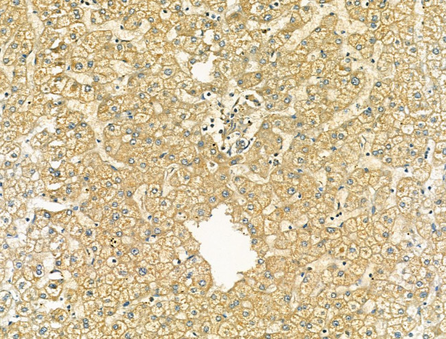 OCIAD1 Antibody in Immunohistochemistry (Paraffin) (IHC (P))