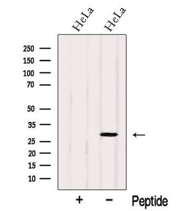 OCIAD1 Antibody in Western Blot (WB)