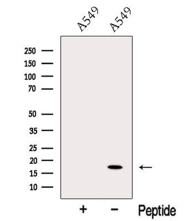 ODAM Antibody in Western Blot (WB)