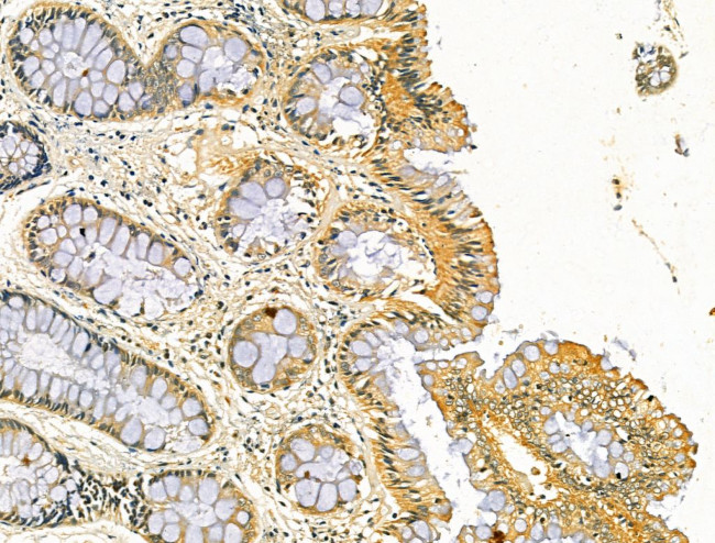 ODF2L Antibody in Immunohistochemistry (Paraffin) (IHC (P))