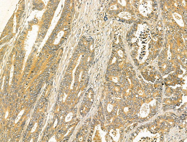 ODF2L Antibody in Immunohistochemistry (Paraffin) (IHC (P))