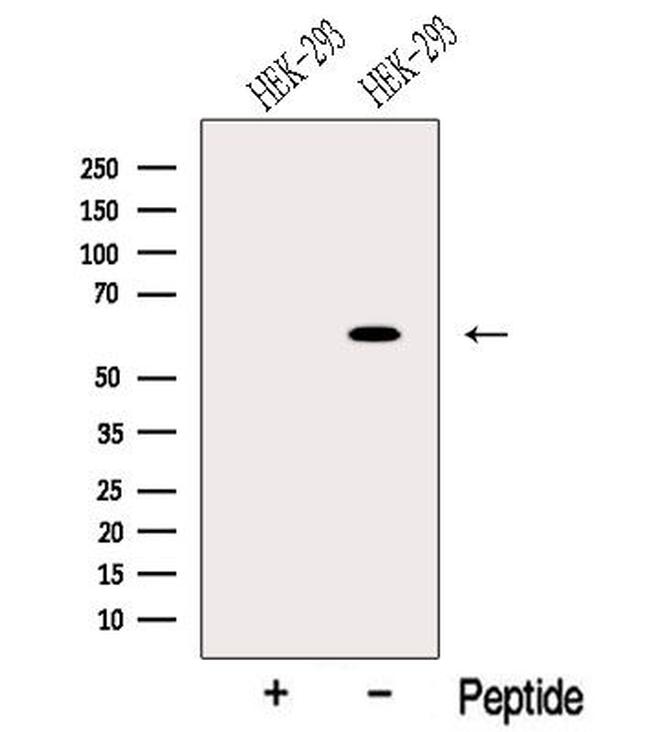 ODF2L Antibody in Western Blot (WB)