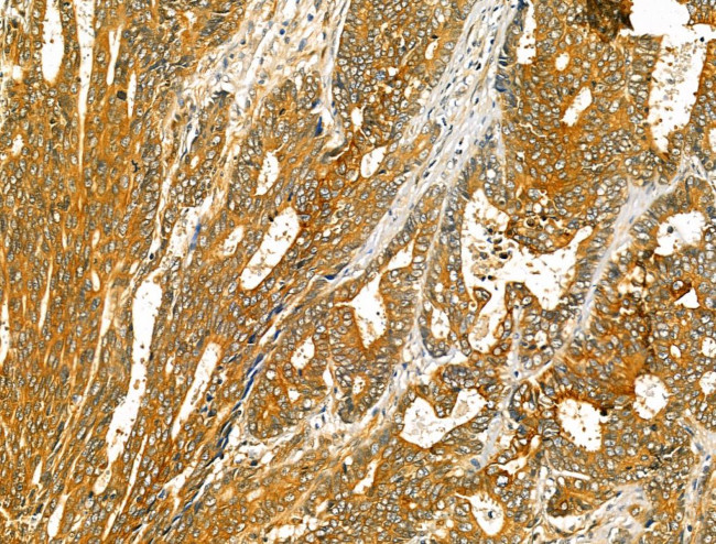 TENM1 Antibody in Immunohistochemistry (Paraffin) (IHC (P))