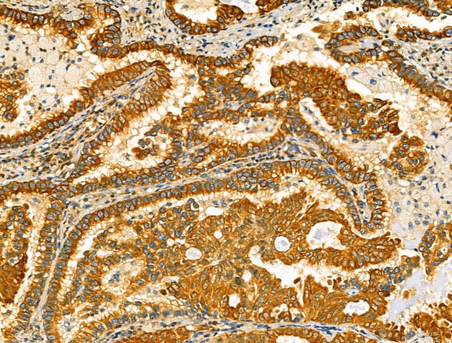 TENM1 Antibody in Immunohistochemistry (Paraffin) (IHC (P))