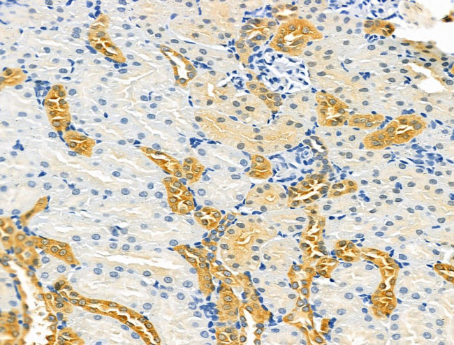 TENM1 Antibody in Immunohistochemistry (Paraffin) (IHC (P))