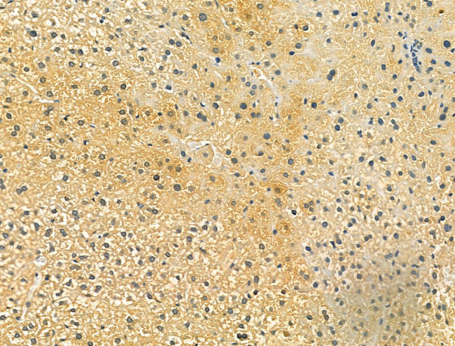 OGDHL Antibody in Immunohistochemistry (Paraffin) (IHC (P))