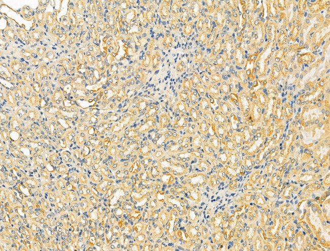 OGDHL Antibody in Immunohistochemistry (Paraffin) (IHC (P))