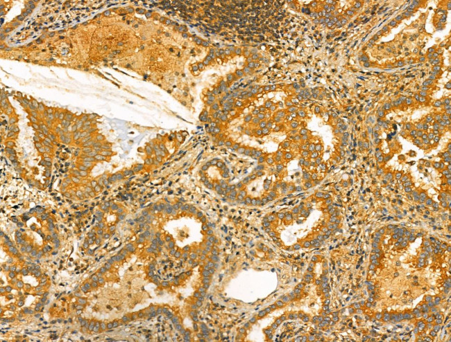 OGDHL Antibody in Immunohistochemistry (Paraffin) (IHC (P))