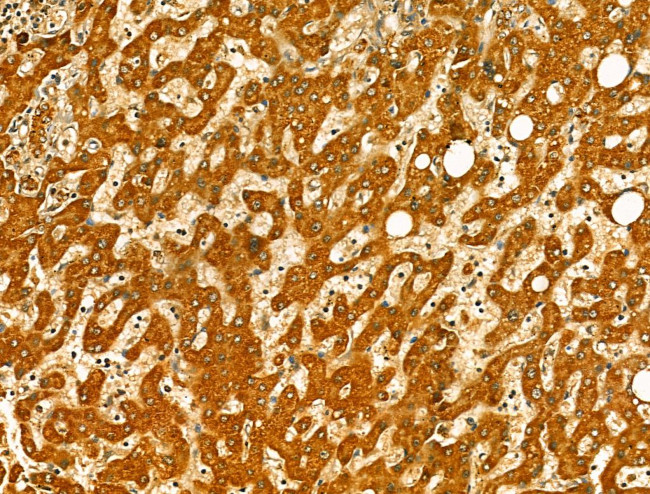 OGDHL Antibody in Immunohistochemistry (Paraffin) (IHC (P))