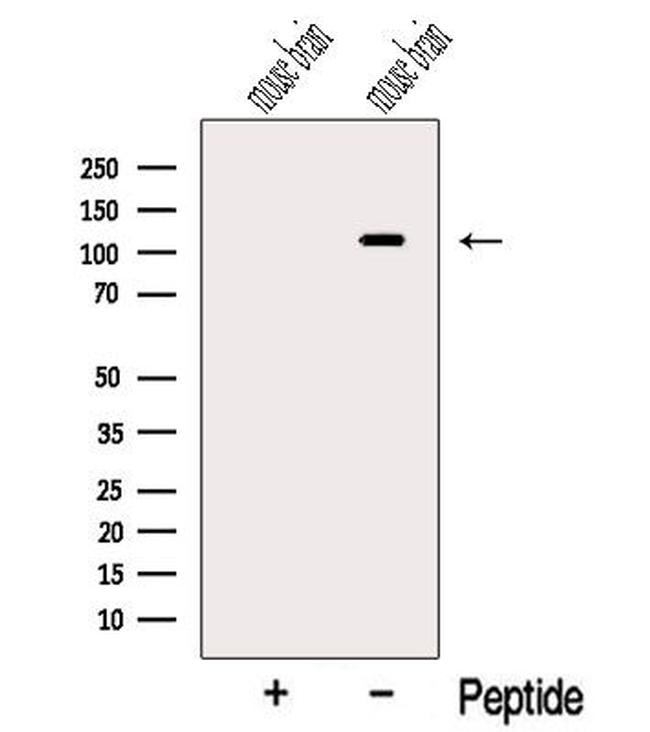 OGDHL Antibody in Western Blot (WB)