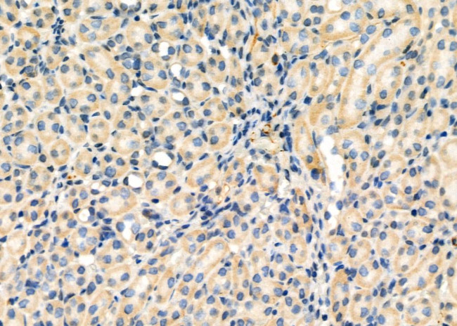 GNA13 Antibody in Immunohistochemistry (Paraffin) (IHC (P))