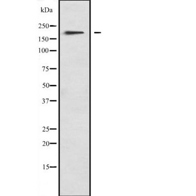 MYO1F Antibody in Western Blot (WB)