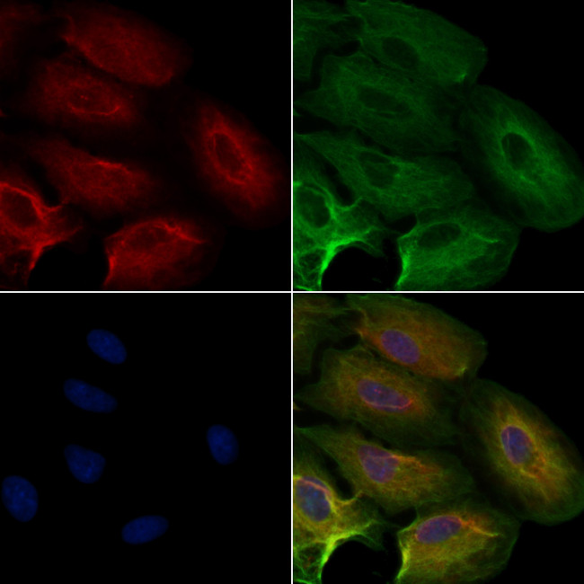 NDUFB6 Antibody in Immunocytochemistry (ICC/IF)