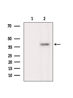 NeuroD6 Antibody in Western Blot (WB)