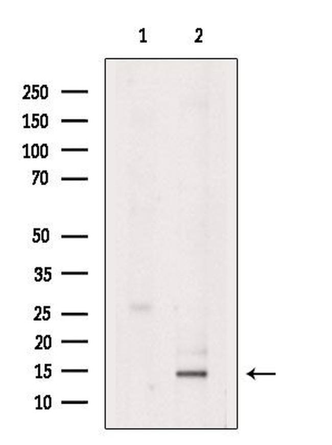 Eotaxin 2 Antibody in Western Blot (WB)