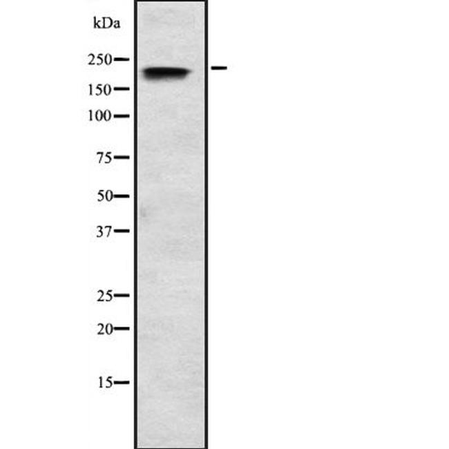 SCN3A Antibody in Western Blot (WB)