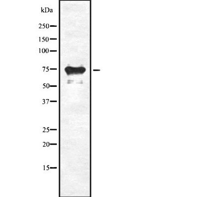 SLC34A2 Antibody in Western Blot (WB)