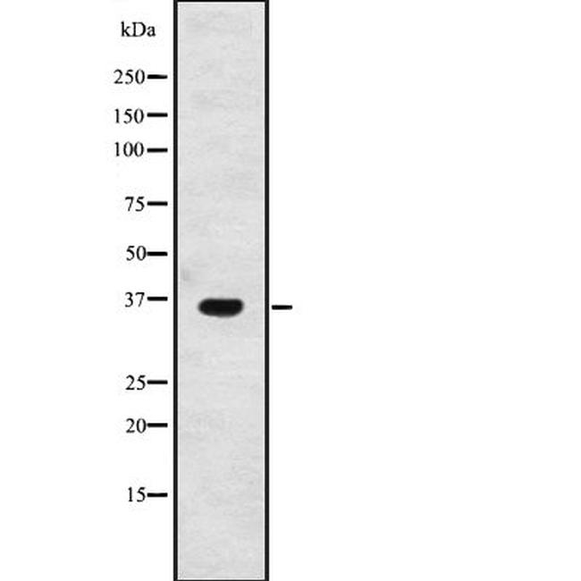 GPSN2 Antibody in Western Blot (WB)