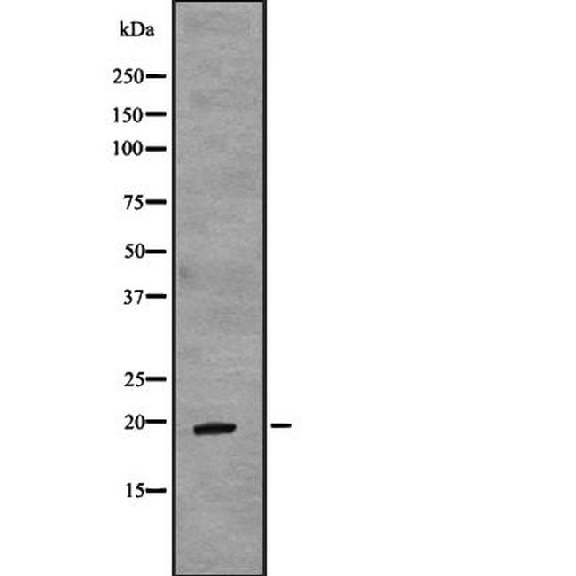 TCAP Antibody in Western Blot (WB)