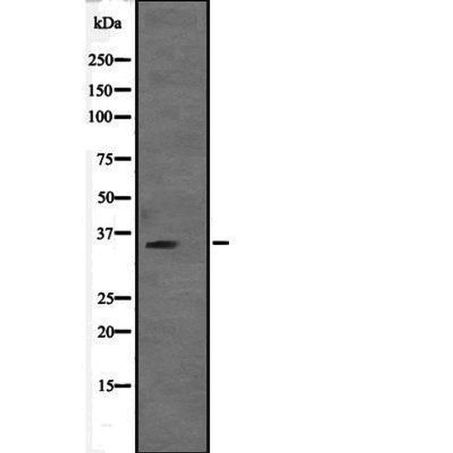 VGLL2 Antibody in Western Blot (WB)