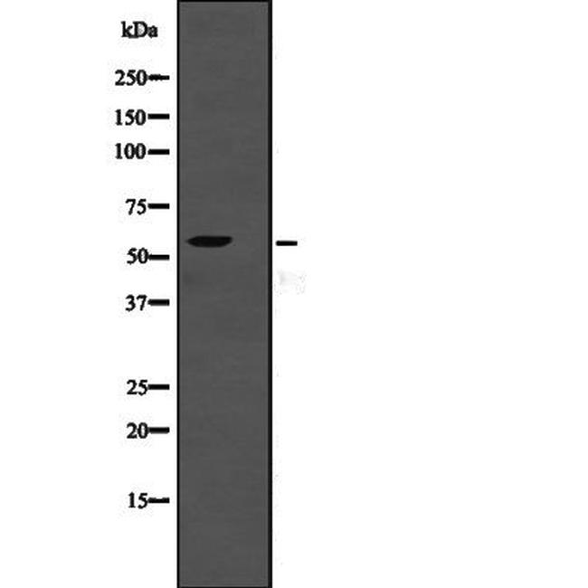 TSEN2 Antibody in Western Blot (WB)