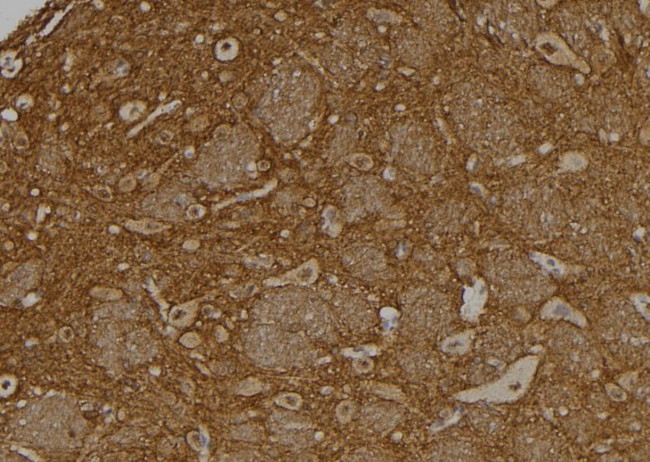 USP37 Antibody in Immunohistochemistry (Paraffin) (IHC (P))