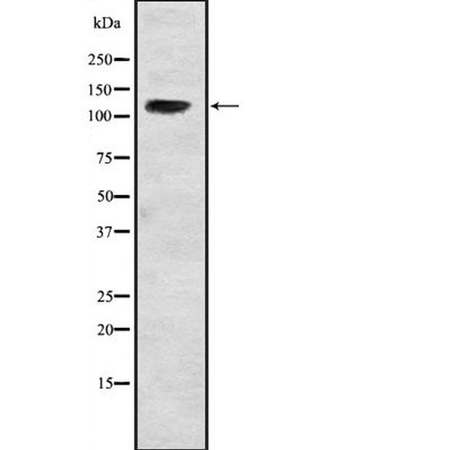 USP37 Antibody in Western Blot (WB)