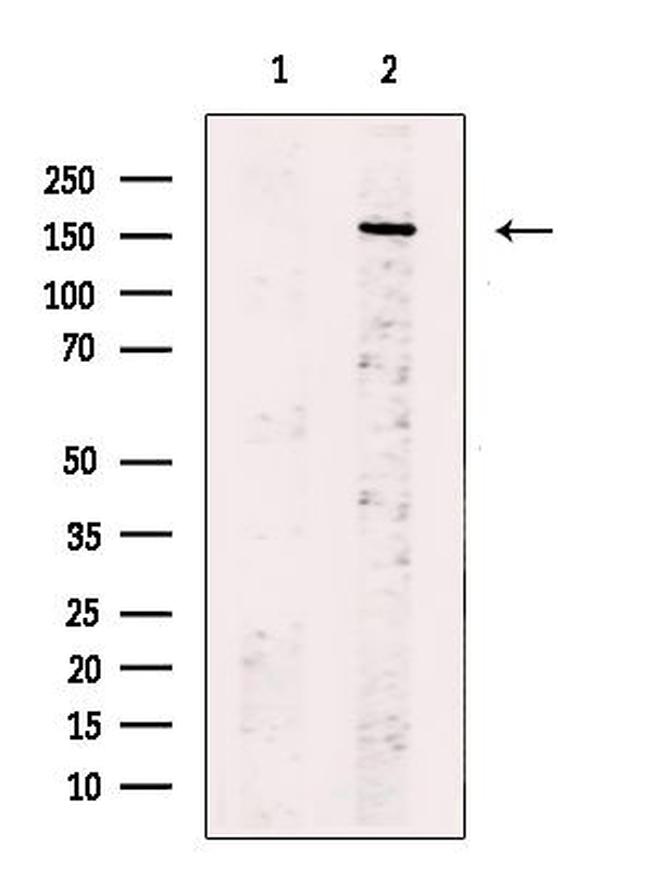 CD109 Antibody in Western Blot (WB)