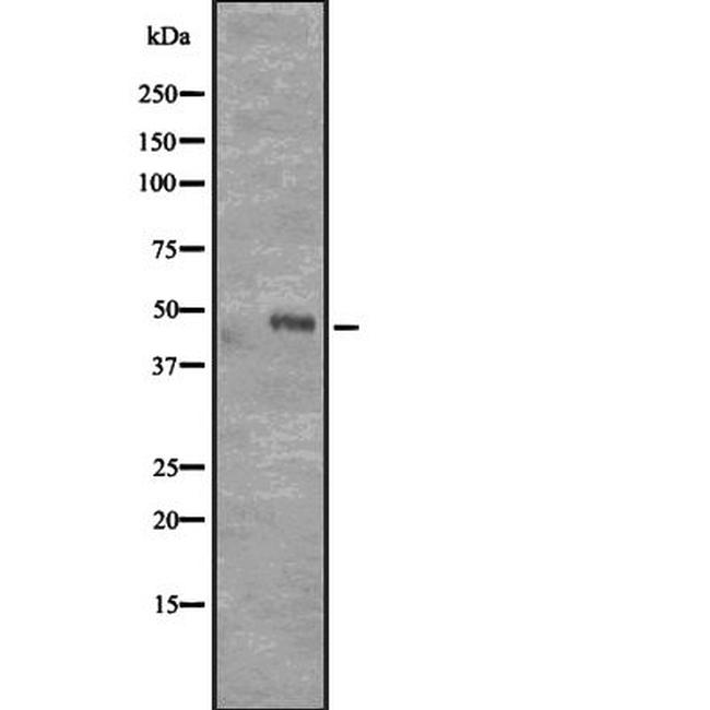 CD177 Antibody in Western Blot (WB)