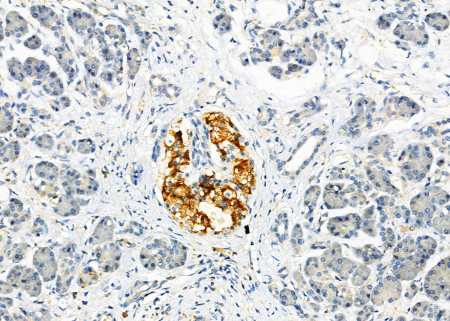 CD97 Antibody in Immunohistochemistry (Paraffin) (IHC (P))