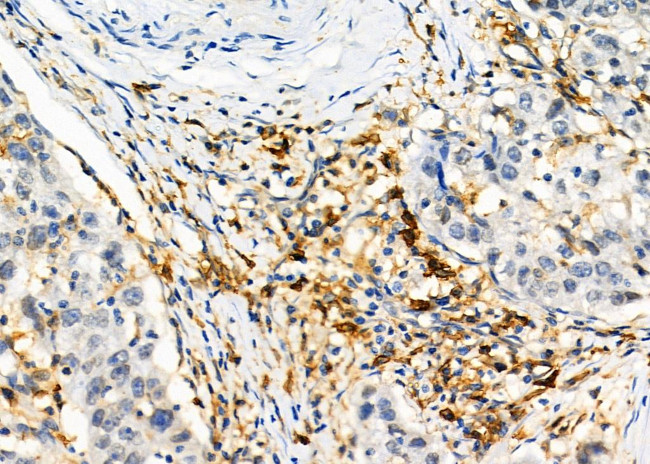 CD97 Antibody in Immunohistochemistry (Paraffin) (IHC (P))