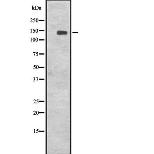 CENPJ Antibody in Western Blot (WB)