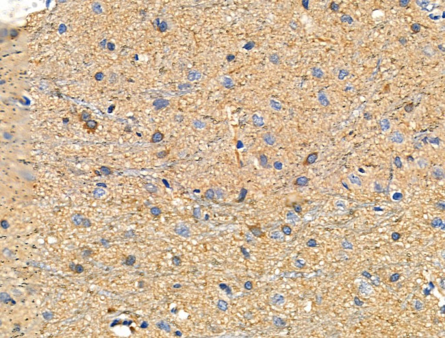 ZPK Antibody in Immunohistochemistry (Paraffin) (IHC (P))