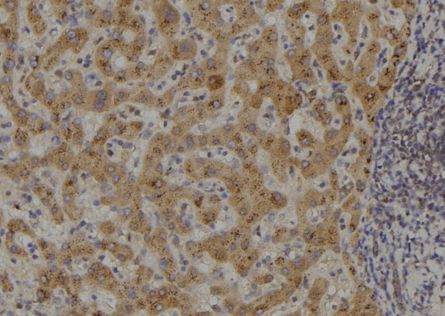 NIK Antibody in Immunohistochemistry (Paraffin) (IHC (P))