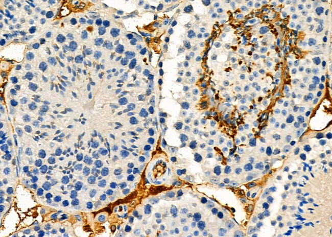 NIK Antibody in Immunohistochemistry (Paraffin) (IHC (P))