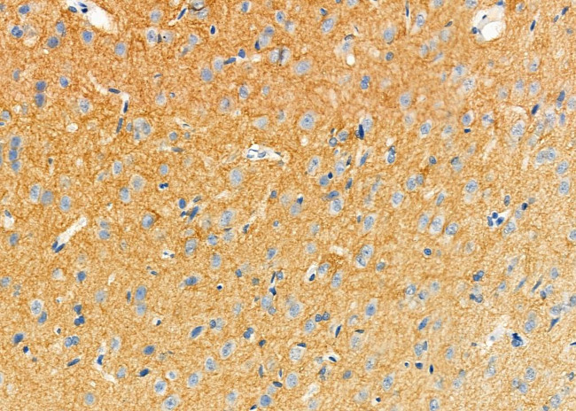 NIK Antibody in Immunohistochemistry (Paraffin) (IHC (P))