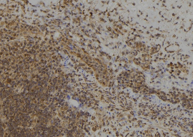 MAGED4 Antibody in Immunohistochemistry (Paraffin) (IHC (P))