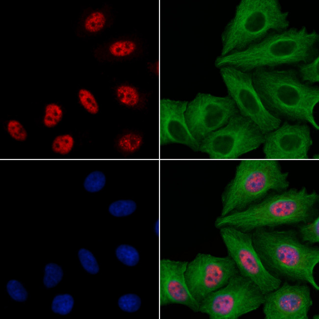 SIVA1 Antibody in Immunocytochemistry (ICC/IF)