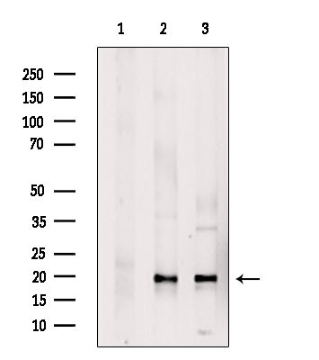 SIVA1 Antibody in Western Blot (WB)