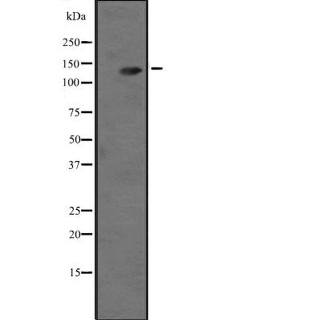 Adenylate Cyclase 3 Antibody in Western Blot (WB)